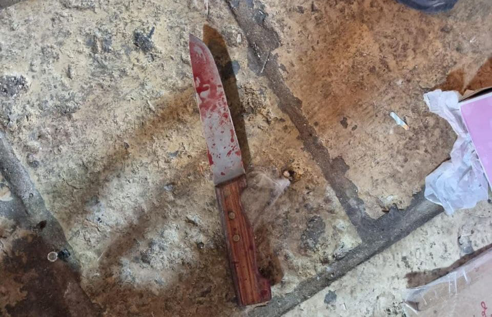 שני שוטרים נפצעו בפיגוע בעיר העתיקה