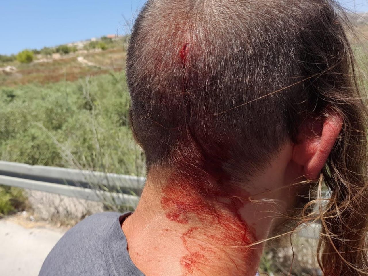 שבי שומרון: נער יהודי נפצע מאבן שזרקו ערבים